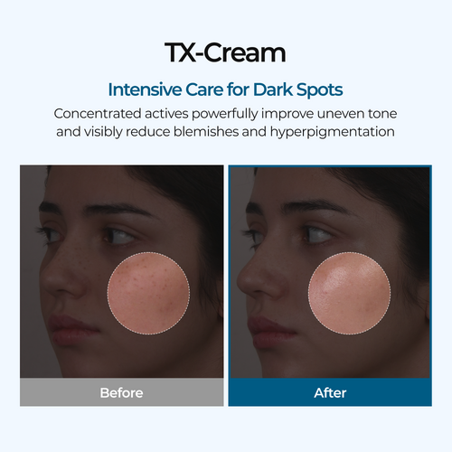 TX Cream